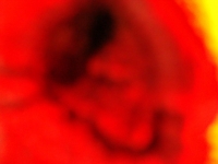 Foto/Print